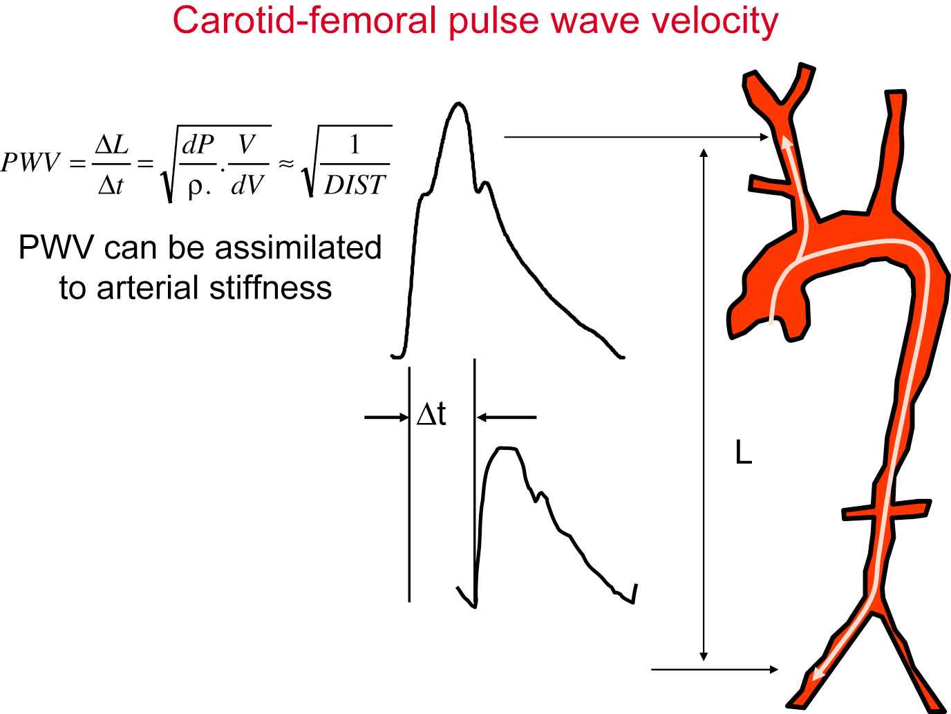 Assessment of pulse wave velocity Atlantis Press
